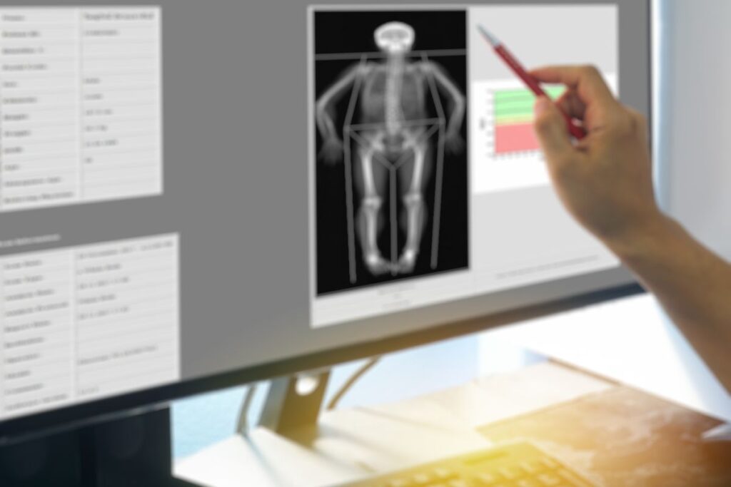 exame-osteoporose-dra-jessica-moraes-endocrinologista-sao-paulo