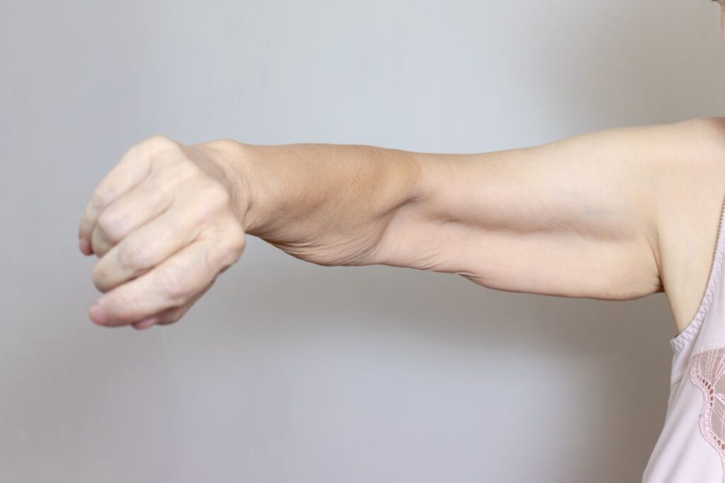 Sarcopenia: como tratar a perda de força e massa muscular?